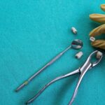 עקירת שן בינה