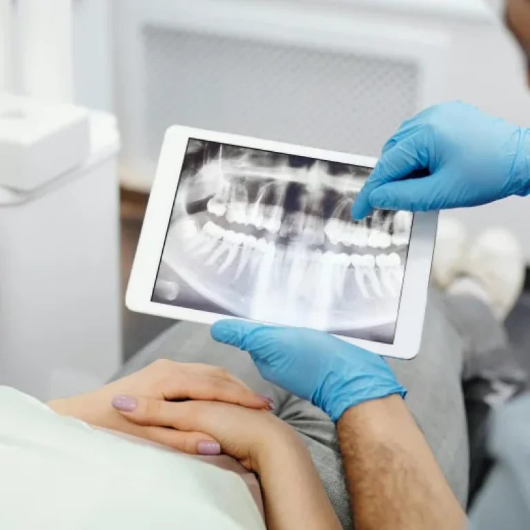 השתלת עצם והרמת סינוס